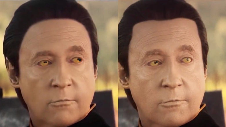 The original hairline (left) and the updated hairline (right).
