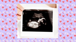 A sonogram.