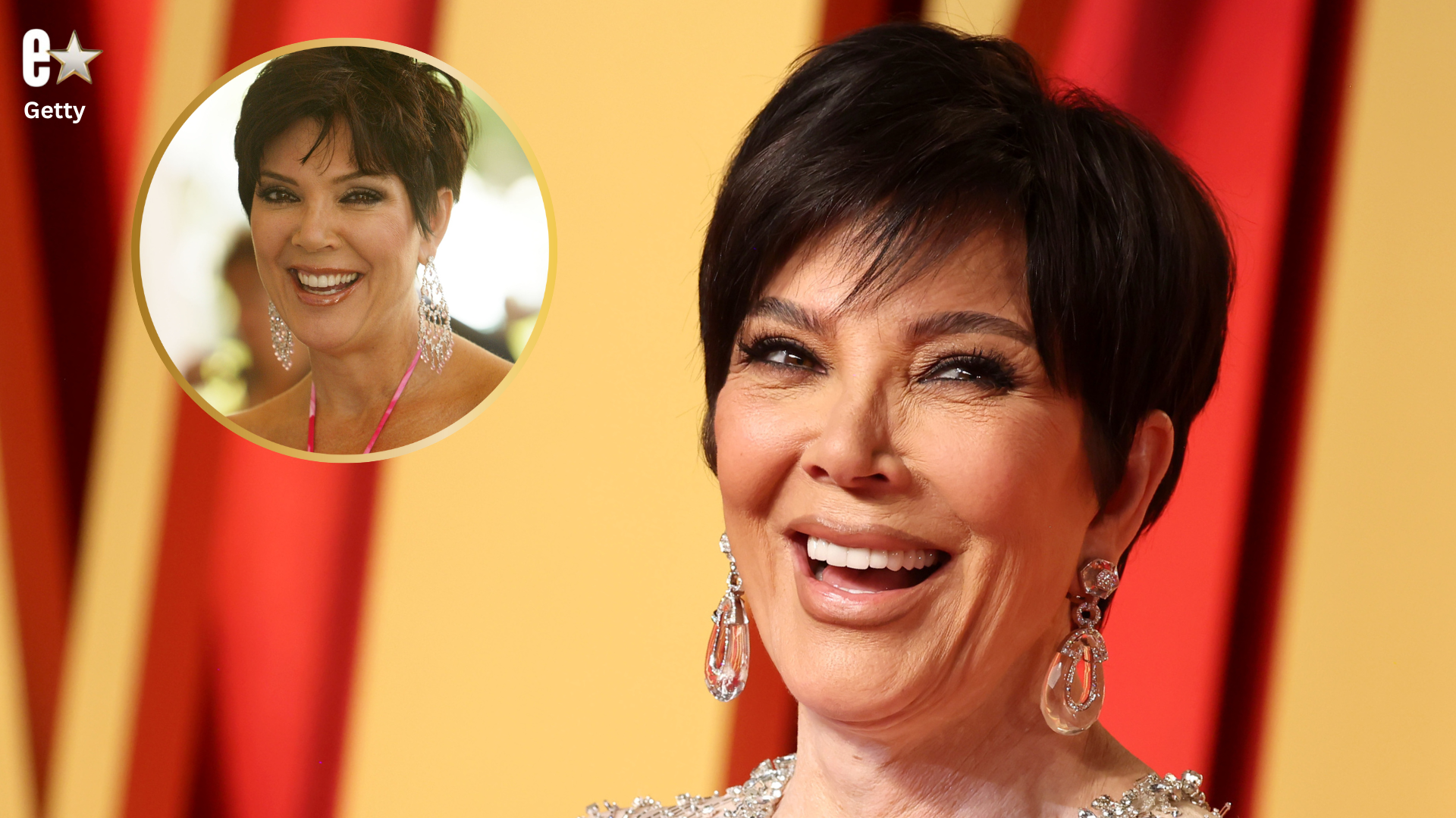 Kris Jenner, 69, Reveals Facelift Refresh