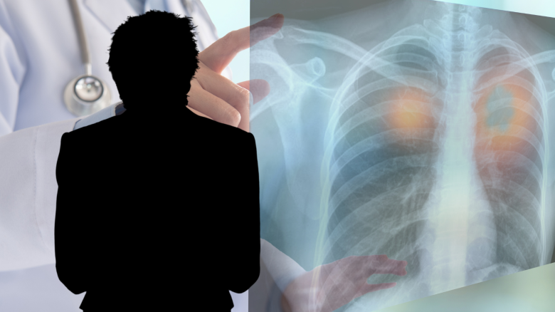 Barry Manilow