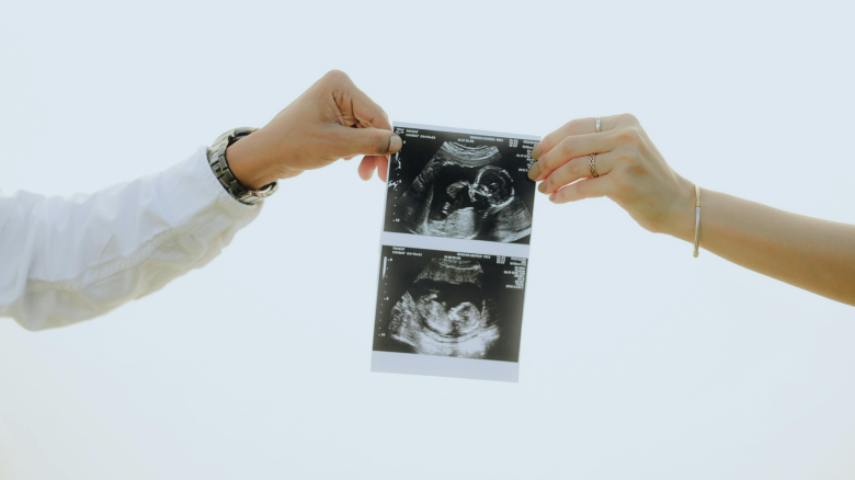 Ultrasound