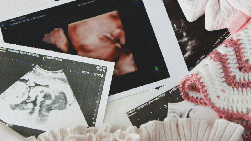 Pregnancy Announcement