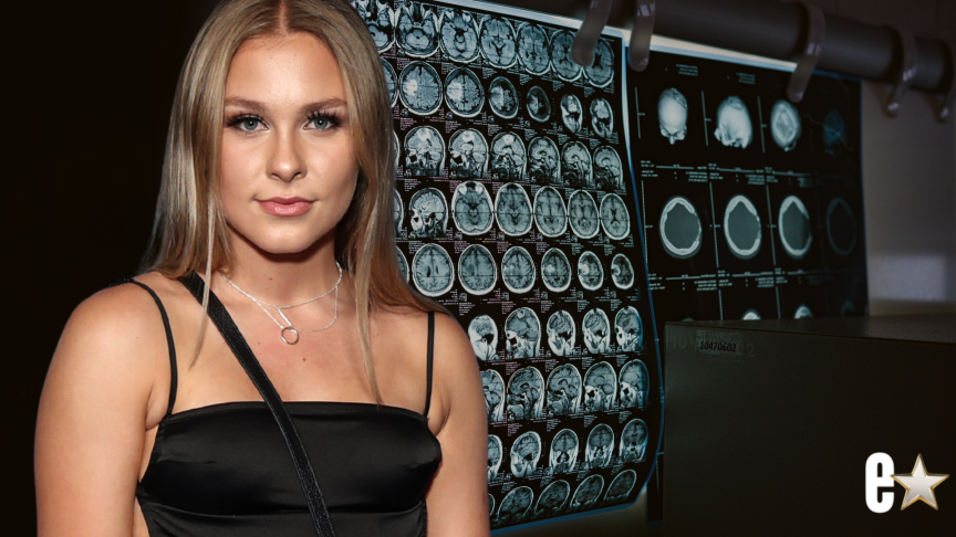 Alea O’Shea, 25, Battles Brain Cancer